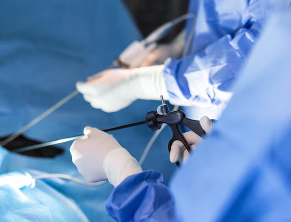 Laparoscopic Hysterectomy